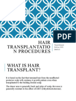 Hair Transplant Procedures Explained