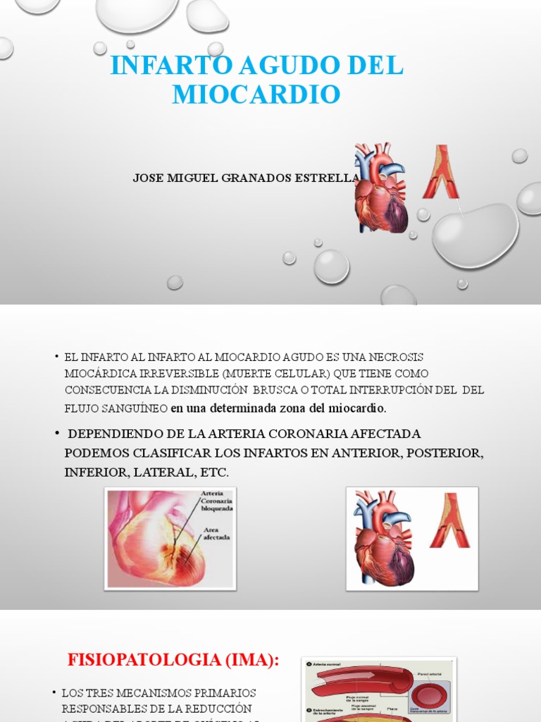 Infarto Agudo Del Miocardio | PDF | Infarto de miocardio | Isquemia