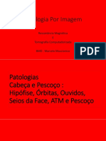 Patologia Por Imagem RM -TC- Cabeça e Pescoço-Pós- Senac