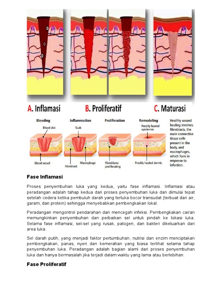 Fase Inflamasi dalam Penyembuhan Luka | PDF | Sains & Matematika