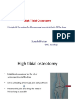 High Tibial Osteotomy: Suresh Dhakar