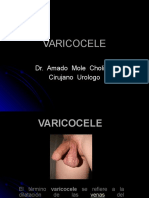 Varicocele