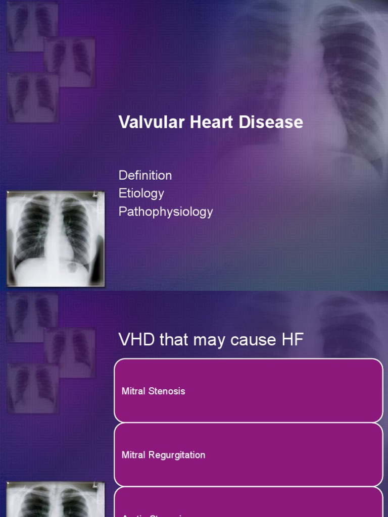 Valvular Heart Disease Overview | PDF | Heart Valve | Heart