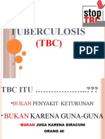 Cara Mengatasi Tuberkulosis