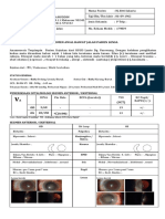 K218 - AB-HJ - ST SAKARIA - OD Katarak Senilis Matur (NO5NC5 C5) OS Katarak Senilis Imatur (NO4NC4 C4)