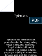 Epistaksis