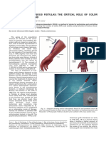 Dialysis Arteriovenous Fistulas The Critical Role