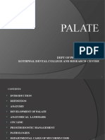 Palate: Sanjoy Dutta PG1 Year Dept of Prosthodontics Kothiwal Dental College and Research Centre