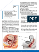 Posterior Vaginal Wall & Perineal Body Repair: A Guide For Women