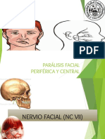 Facial Paralisis