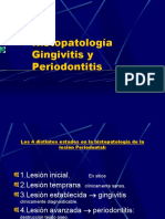 Histopatología Periodontitis