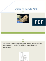 Instalacion de Sonda NSG