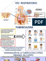 Aparato Respiratorio - Turberculosis