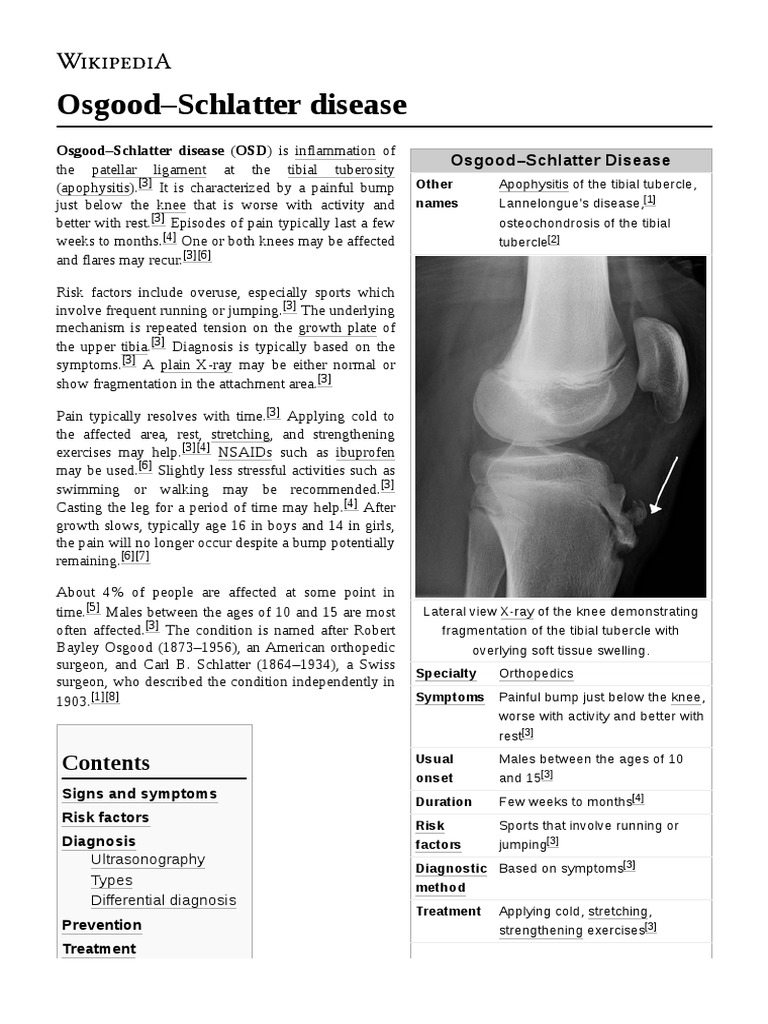 Osgood Schlatter Disease Pdf , Osgood-Schlatter Causes, Symptoms, and ...