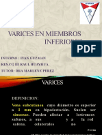 VARICES DE MIEMBROS INFERIORES