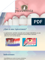 Apicectomía