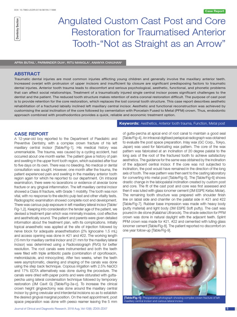 Angulated Custom Cast Post and Core Restoration Fo | PDF | Dentistry ...