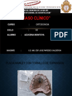 Caso Clinico de Ortodoncia