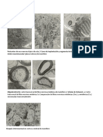 Ampliación Histología TEM