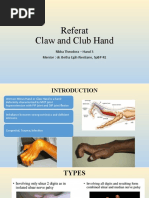 Referat Claw and Club Hand: Ribka Theodora - Hand 3 Mentor: Dr. Betha Egih Riestiano, Spbp-Re