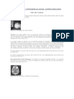 235026097 Protocolos Tomografia Axial Computarizada (2)