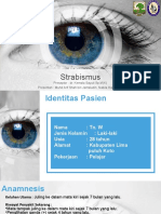 BST Strabismus