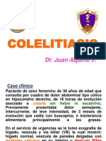 11COLELITIASIS