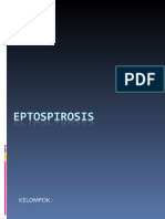 EPTOSPIROSIS