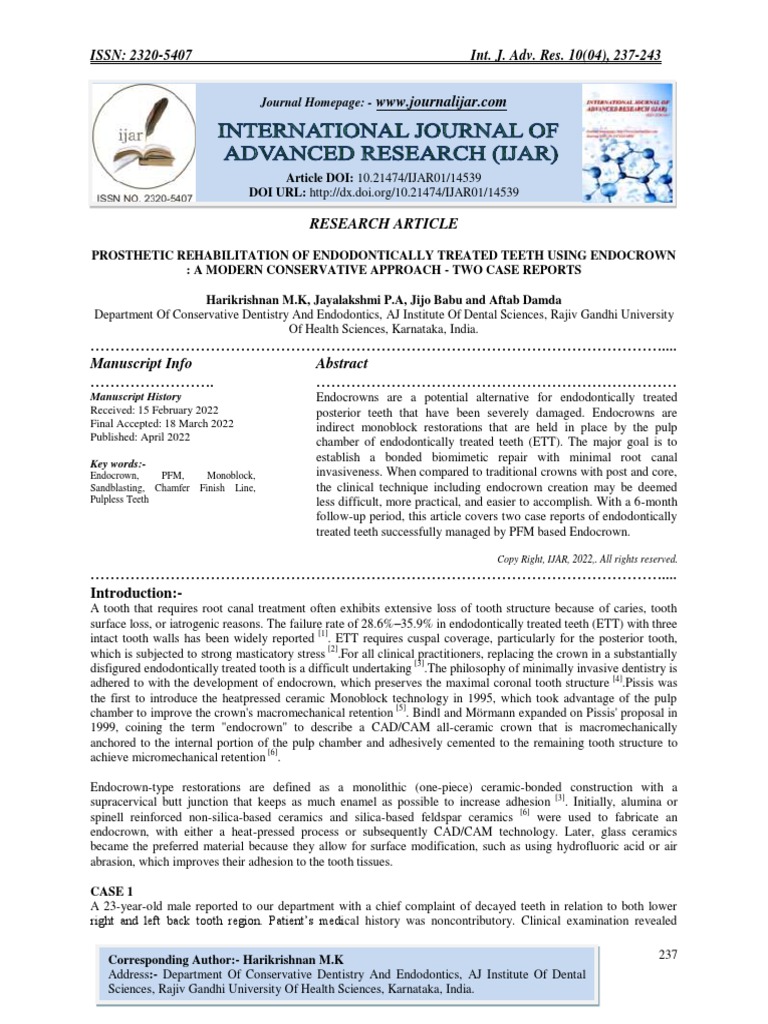 Prosthetic Rehabilitation of Endodontically Treated Teeth Using