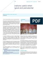 Cervical Restorations Useful When Assessing Gingival and Periodontal Health