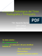 Anatomia radiológica de tórax Radiografía y tomografía 2011 para la comunidad