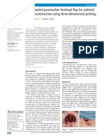 Ziegler and Oyer. Prelaminated - Paramedian - Forehe