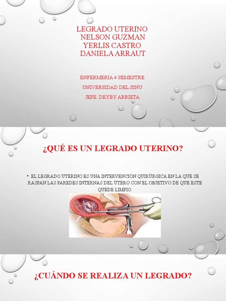 Legrado Uterino Video : Dilatación y raspado – GYTK