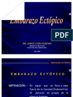 Embarazo Ectópico