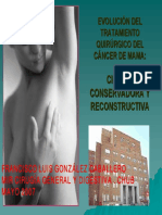 cirugia_cancer_mama