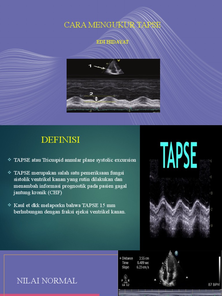 Cara Mengukur Tapse, Echo PDF