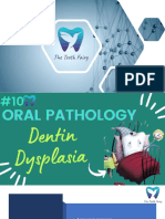 Dentin Dysplasia