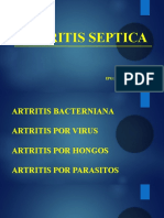 Artritis Septica