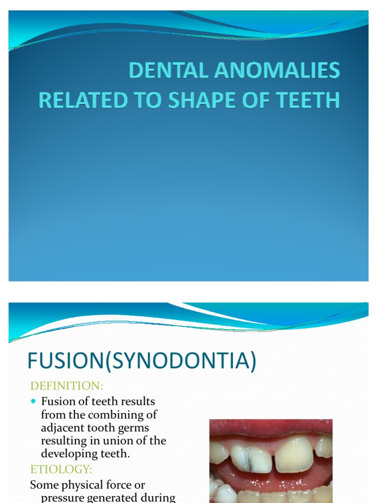 Dental Anomalies Related to Shape of Teeth Human Tooth Tooth Enamel