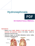 Hydronephrosis: Dr.K.Sathish Kumar, MD (Hom) .