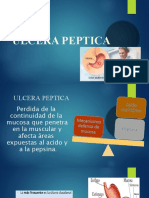 Ulcera Peptica Expo 22