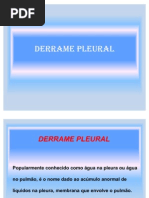 DERRAME PLEURAL