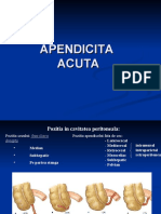 Apendicita Acuta