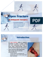 Open Fracture Raju3