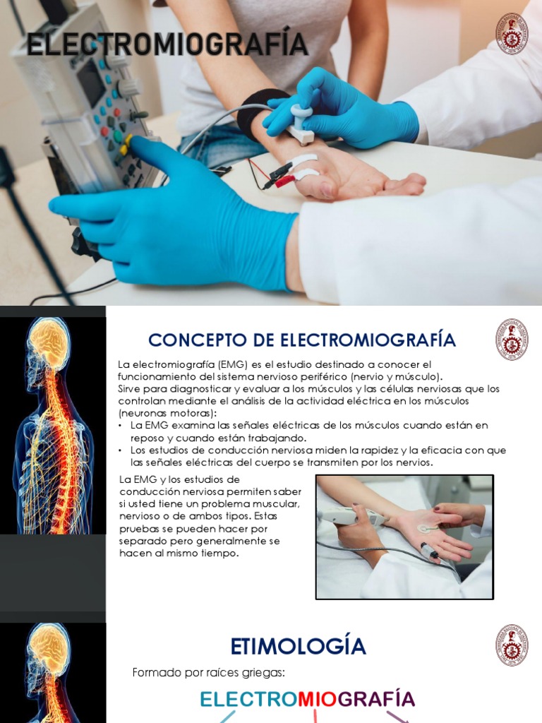 Electromiografía | PDF | Electromiografia | Sistema nervioso