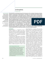 Acute Glomerulonephritis