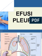 EFUSI PLEURA PPTX