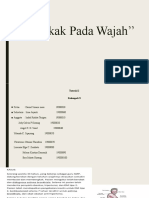 TUTORIAL 2 ''Bengkak Pada Wajah'' ''