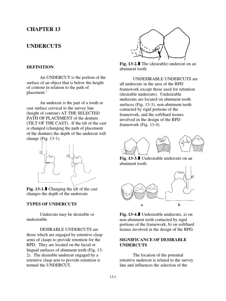 Chapter 13 Undercuts PDF Mouth Dentistry