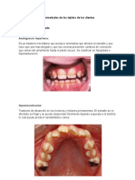 Enfermedades de los tejidos de los dientes (morfologia)